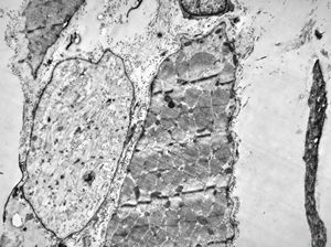 F,56y. | regenerating muscle cell F,56y. | regenerating muscle cell